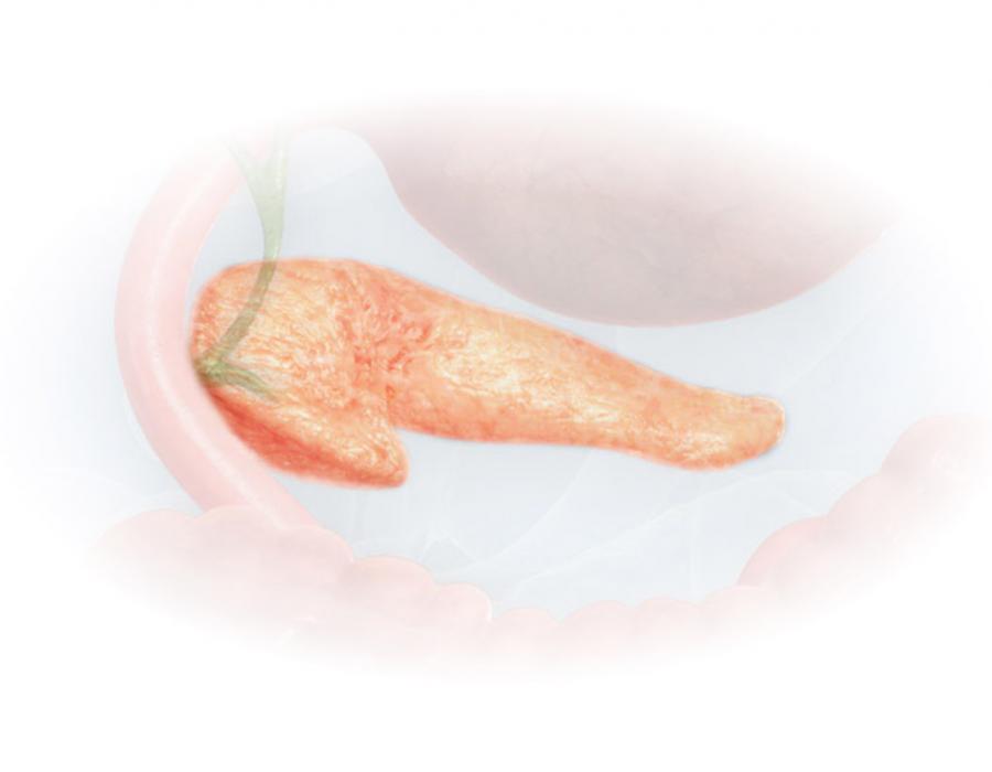 Pancreatic tumors