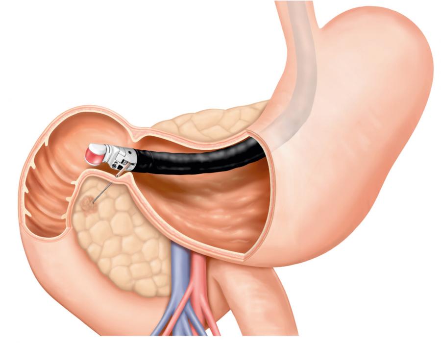 Able to obtain a tissue biopsy